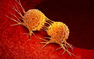 霉菌这种致癌物藏在家里：很多人浑然不知