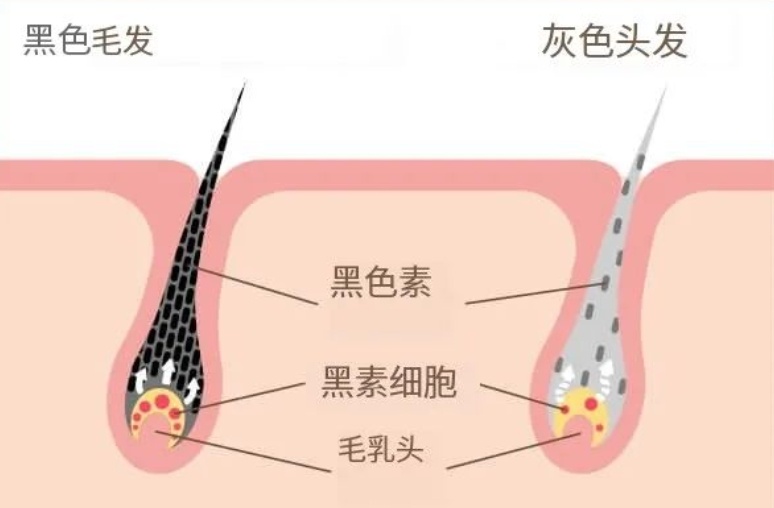 头发白了还能变黑吗？医生的答案出乎意料-第1张图片-风享汇